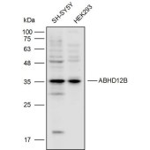 Solarbio K110305P Anti-ABHD12B Polyclonal Antibody