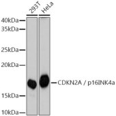Solarbio K009357P Anti-CDKN2A/p16INK4a  Rabbit Polyclonal Antibody