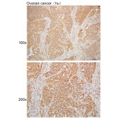 Solarbio K110028P Anti-DMWD Polyclonal Antibody