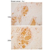 Solarbio K110515P Anti-QPCTL Polyclonal Antibody