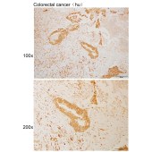 Solarbio K109999P Anti-BCKDK Polyclonal Antibody