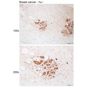 Solarbio K112173P Anti-ABCC12 Polyclonal Antibody