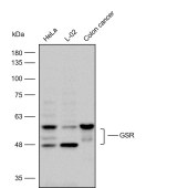 Solarbio K112241P Anti-GSR Polyclonal Antibody