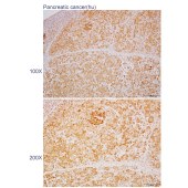 Solarbio K110477P Anti-DDX49 Polyclonal Antibody