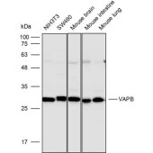 Solarbio K110333P Anti-VAPB Polyclonal Antibody
