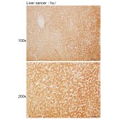 Solarbio K110378P Anti-ACADSB Polyclonal Antibody