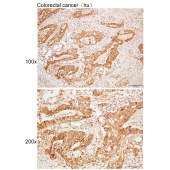 Solarbio K109957P Anti-TPH1 Polyclonal Antibody