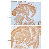 Solarbio K110384P Anti-STXBP2 Polyclonal Antibody