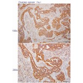 Solarbio K112280P Anti-HYAL3 Polyclonal Antibody