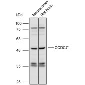 Solarbio K110132P Anti-CCDC71 Polyclonal Antibody