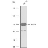 Solarbio K003067P Anti-PADI4 Rabbit Polyclonal Antibody