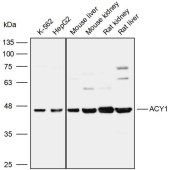 Solarbio K110023P Anti-ACY1 Polyclonal Antibody