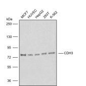 Solarbio K008218P Anti-CDH3 Polyclonal Antibody