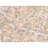 Solarbio K009834P Anti-STX5 Polyclonal Antibody