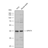Solarbio K112287P Anti-GPAT4 Polyclonal Antibody