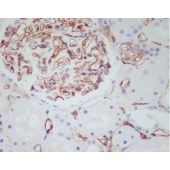 Solarbio K009772P Anti-CD34 Polyclonal Antibody