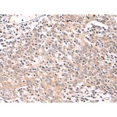 Solarbio K009875P Anti-PLOD3 Polyclonal Antibody
