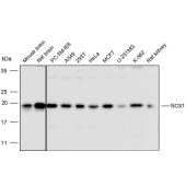 Solarbio K110501P Anti-NCS1 Polyclonal Antibody
