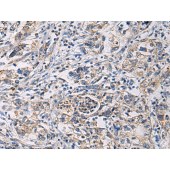 Solarbio K009865P Anti-CYTIP Polyclonal Antibody