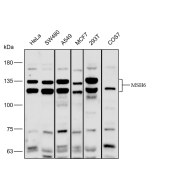 Solarbio K112171P Anti-MSH6 Polyclonal Antibody