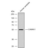 Solarbio K009825P Anti-CAMKK1 Polyclonal Antibody