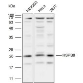 Solarbio K110113P Anti-HSPB8 Polyclonal Antibody