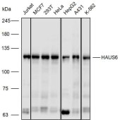 Solarbio K110394P Anti-HAUS6 Polyclonal Antibody