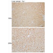 Solarbio K110121P Anti-CTSD Polyclonal Antibody