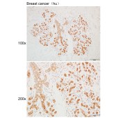 Solarbio K110275P Anti-PYCR3 Polyclonal Antibody