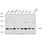 Solarbio K112172P Anti-MSH6 Polyclonal Antibody