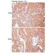 Solarbio K112418P Anti-TTLL9 Polyclonal Antibody