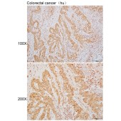 Solarbio K110105P Anti-HSPA13 Polyclonal Antibody
