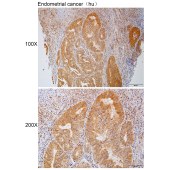 Solarbio K112258P Anti-MKRN2 Polyclonal Antibody