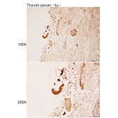 Solarbio K112170P Anti-ANKRD30A Polyclonal Antibody