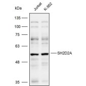 Solarbio K109936P Anti-SH2D2A Polyclonal Antibody
