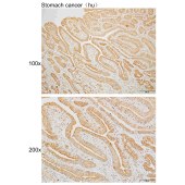 Solarbio K110016P Anti-VPS26B Polyclonal Antibody