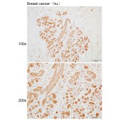 Solarbio K110293P Anti-SCN4B Polyclonal Antibody