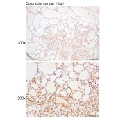 Solarbio K109934P Anti-DNAJB5 Polyclonal Antibody