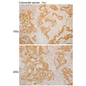 Solarbio K110023P Anti-ACY1 Polyclonal Antibody