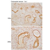 Solarbio K110031P Anti-ABTB1 Polyclonal Antibody