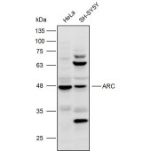 Solarbio K109937P Anti-ARC Polyclonal Antibody