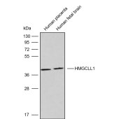 Solarbio K009850P Anti-HMGCLL1 Polyclonal Antibody