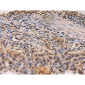 Solarbio K009797P Anti-PDS5B Polyclonal Antibody