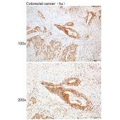 Solarbio K109960P Anti-LCK  Polyclonal Antibody