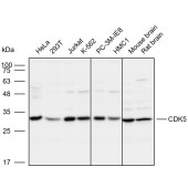 Solarbio K109949P Anti-CDK5 Polyclonal Antibody