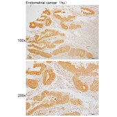 Solarbio K109996P Anti-PREB Polyclonal Antibody