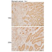 Solarbio K110011P Anti-SNX8 Polyclonal Antibody