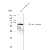 Solarbio K106444P Anti-ALB Polyclonal Antibody