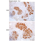 Solarbio K112414P Anti-ASAP2 Polyclonal Antibody
