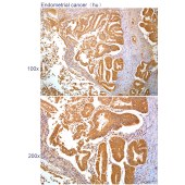 Solarbio K112283P Anti-PIH1D1 Polyclonal Antibody